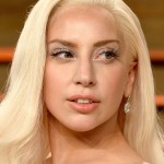 Lady GaGa plastic surgery 141