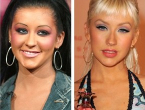 Christina Aguilera before and after plastic surgery 2015 (5)