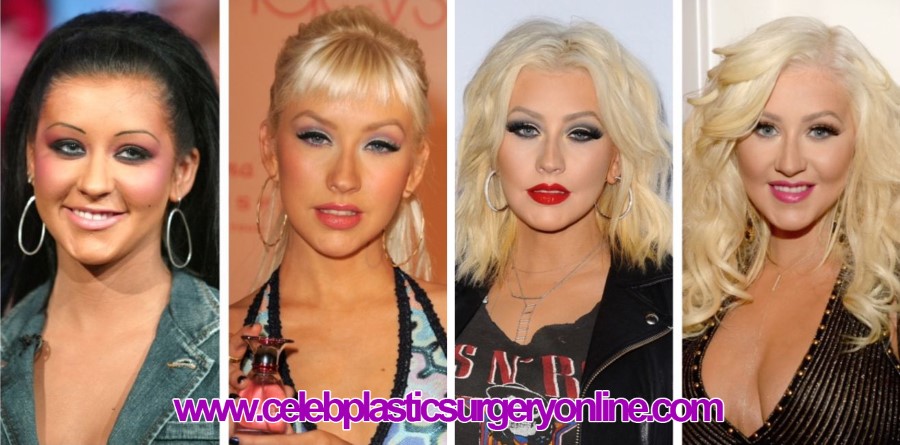 Christina Aguilera before and after plastic surgery 2015