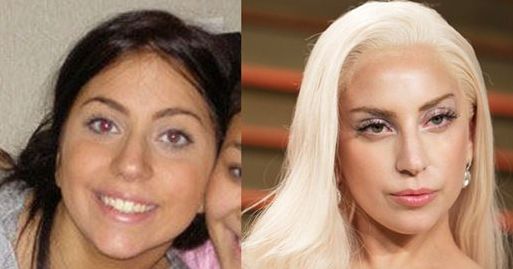 Lady GaGa before and after