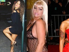 Amber Rose before and after plastic surgery
