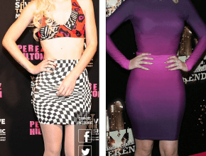 Iggy azalea before and after plastic surgery