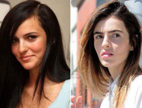 Ali Lohan before and after plastic surgery