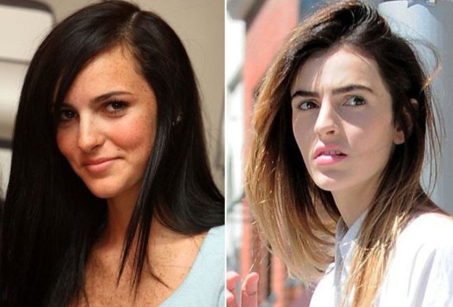 Ali Lohan before and after plastic surgery