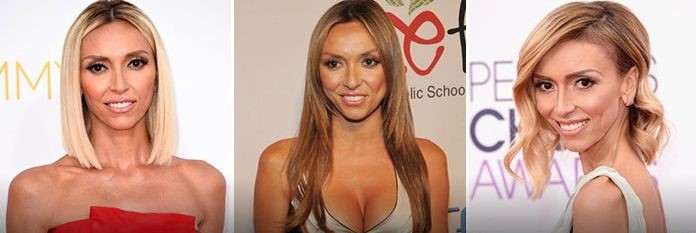 Giuliana Rancic before and after plastic surgery