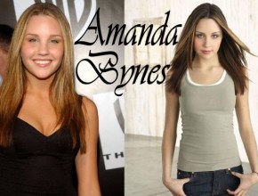 Amanda Bynes before and after plastic surgery 1