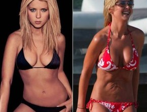 Tara Reid tummy tuck