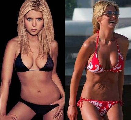 Tara Reid tummy tuck