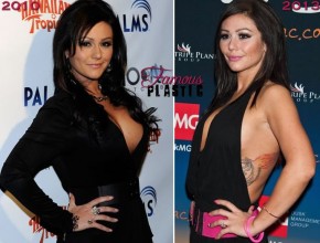Jennifer Lynn Farley JWoww Before and after plastic surgery
