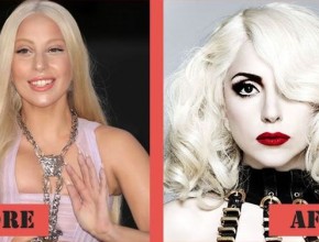 Lady GaGa plastic surgery