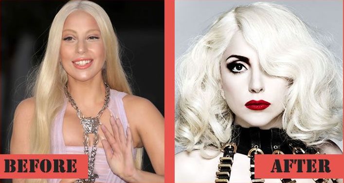 Lady GaGa plastic surgery