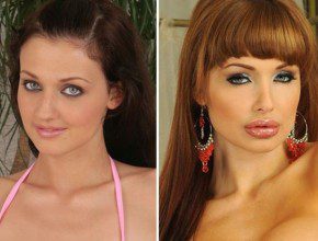 Alleta Ocean plastic surgery