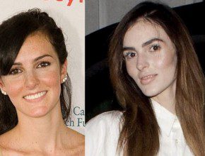 Ali Lohan before and after plastic surgery