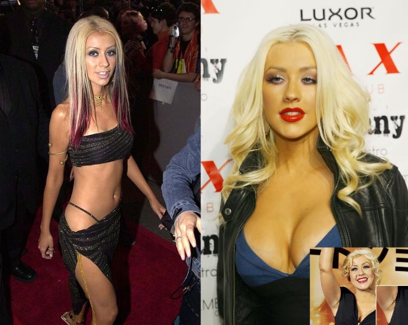 Christina Aguilera plastic surgery before and after