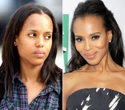 Kerry Washington Before and after plastic surgery