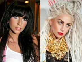 Lady GaGa plastic surgery