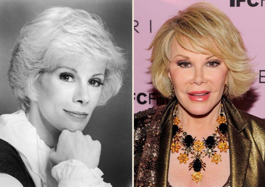 Joan Rivers before and afer plastic surgery