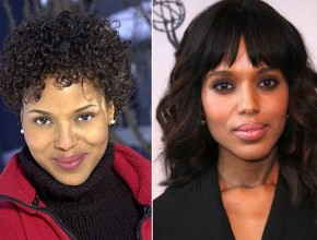 Kerry Washington before and after plastic surgery