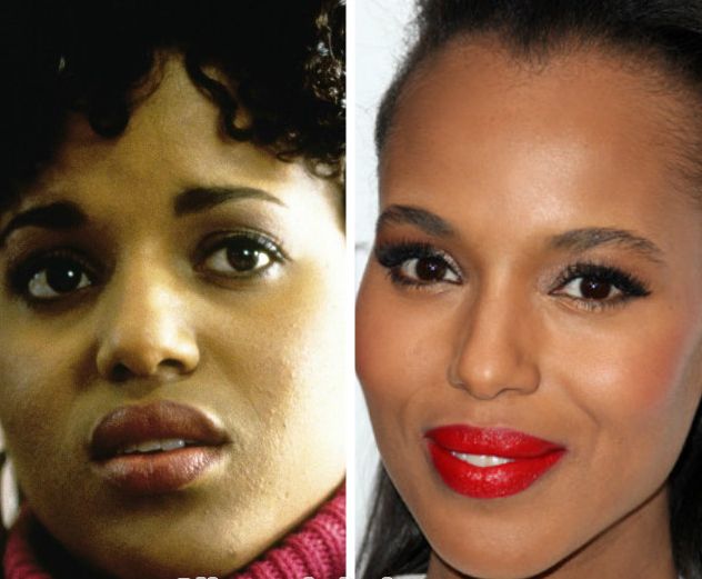 Kerry Washington Nose job