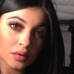 Kylie Jenner plastic surgery 5