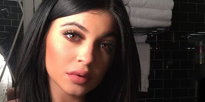 Kylie Jenner plastic surgery 5