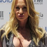 Taylor Armstrong breast augmentation