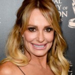 Taylor Armstrong botox fillers