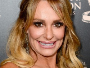 Taylor Armstrong botox fillers