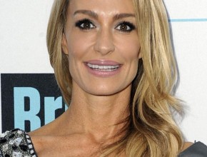 Taylor Armstrong facelift
