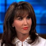 Robin McGraw cosmetic procedures