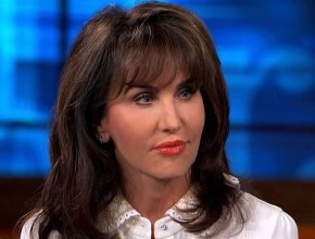 Robin McGraw cosmetic procedures