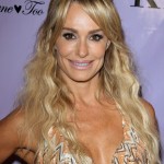 Taylor Armstrong botox fillers