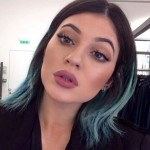 Kylie Jenner plastic surgery 75