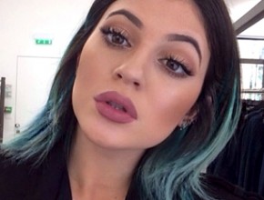 Kylie Jenner plastic surgery 75