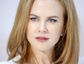 Nicole Kidman after botox injections