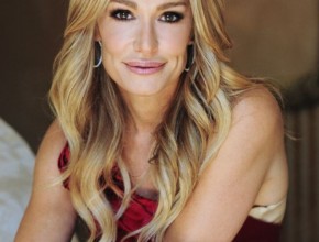 Taylor Armstrong botox fillers