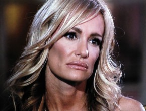 Taylor Armstrong botox fillers