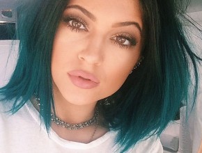 Kylie Jenner plastic surgery 95