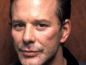 Mickey Rourke plastic surgery after boxing