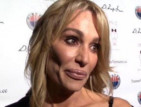 Taylor Armstrong facelift and chin implants