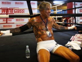 Mickey Rourke plastic surgery after boxing