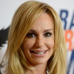 Taylor Armstrong facelift and chin implants