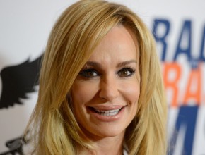 Taylor Armstrong facelift and chin implants