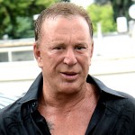 Mickey Rourke plastic surgery after boxing