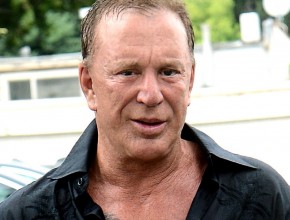 Mickey Rourke plastic surgery after boxing