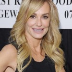 Taylor Armstrong facelift and chin implants