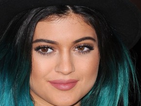 Kylie Jenner plastic surgery 155