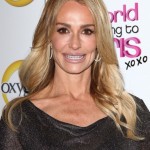 Taylor Armstrong botox fillers