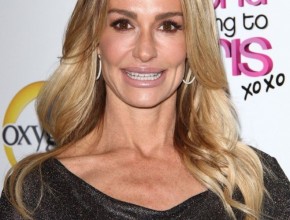 Taylor Armstrong botox fillers