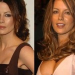 Kate Beckinsale plastic surgery